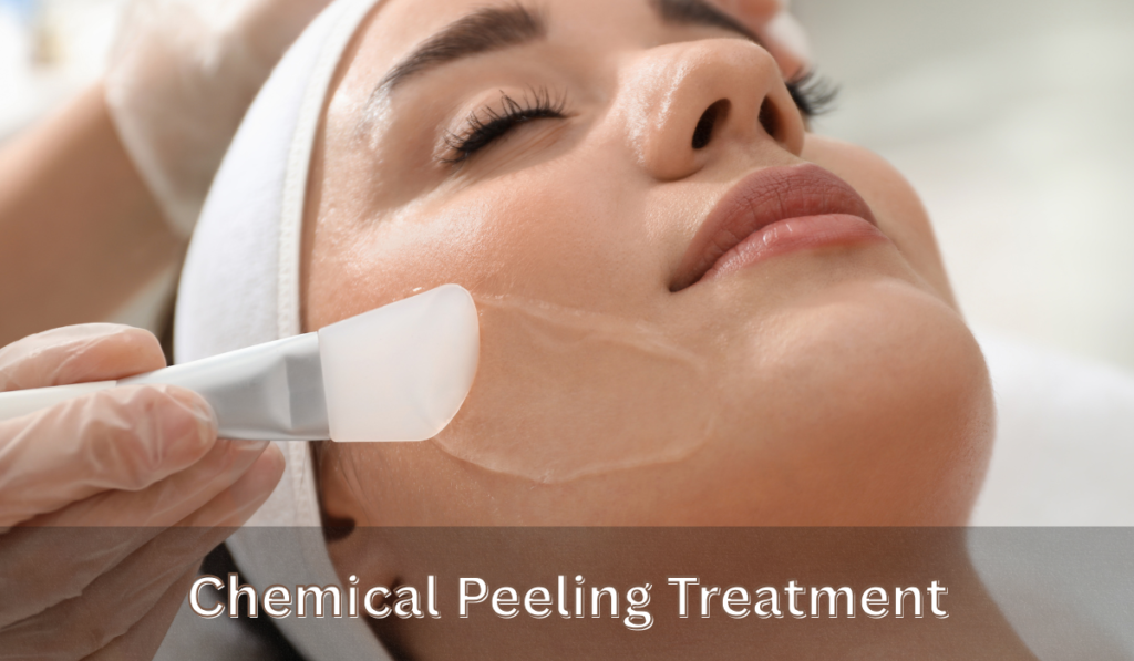 chemical peeling treatment