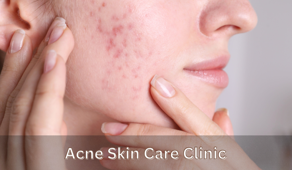 acne skin care clinic