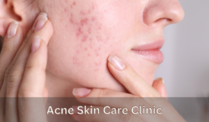 acne skin care clinic
